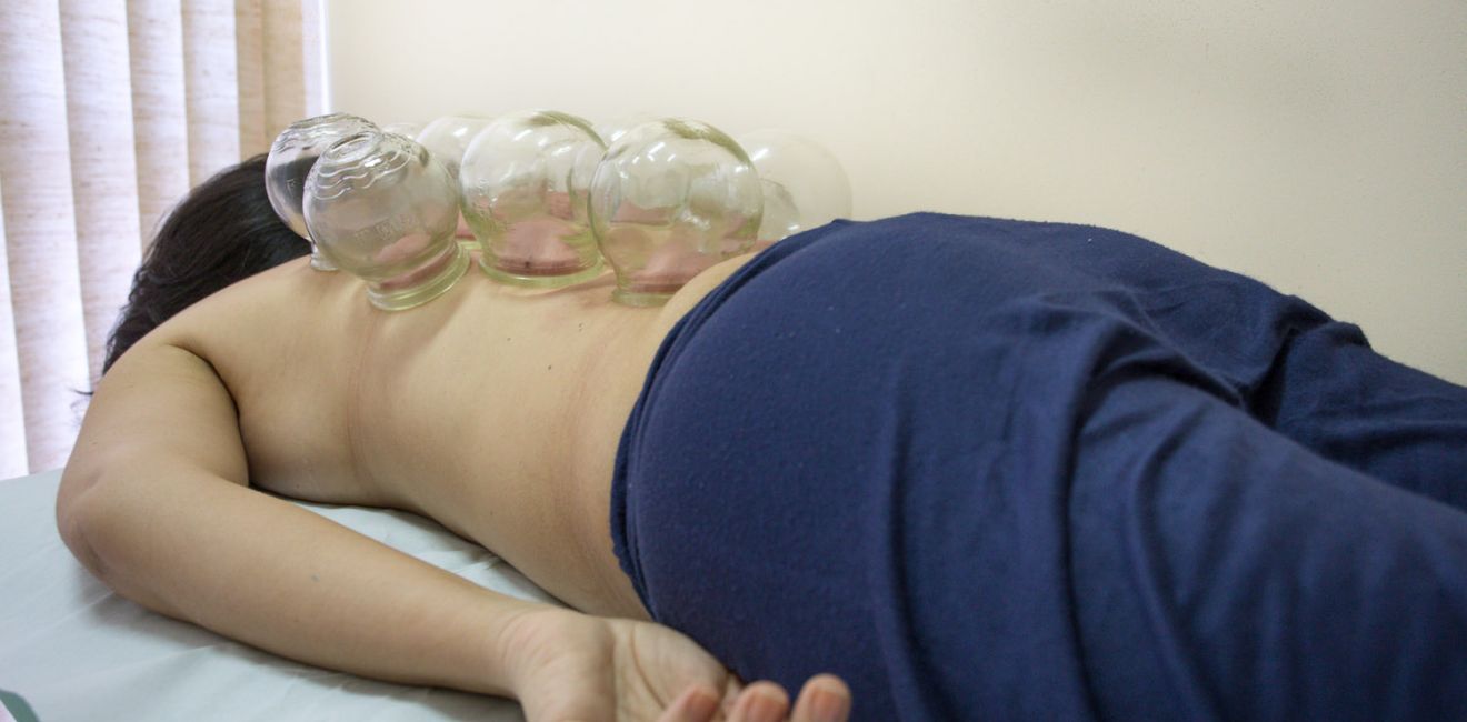 Quanto tempo pode deixar a ventosa no corpo?