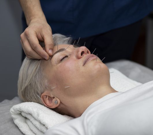 O que é melhor acupuntura ou auriculoterapia? 